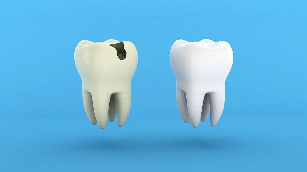 درمان خانگی دندان درد شدید به چه صورت است