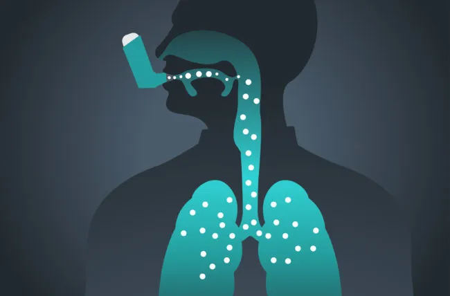 جدیدترین روش درمان آسم کدامند