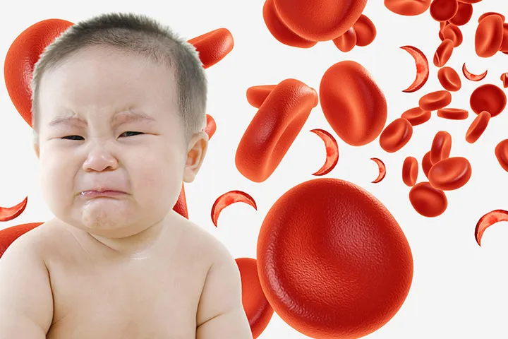 علائم کم خونی در کودکان چیست