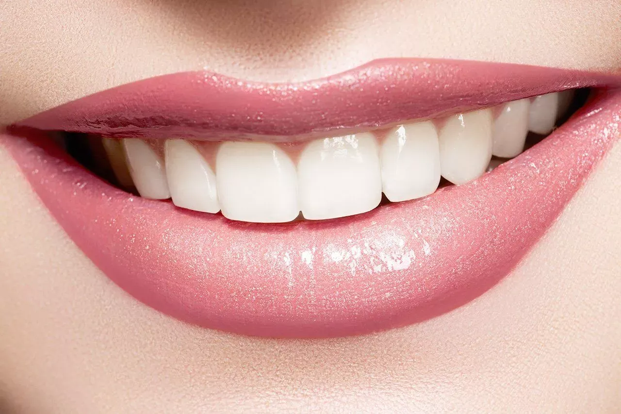 راه های سفید شدن دندان را بشناسید