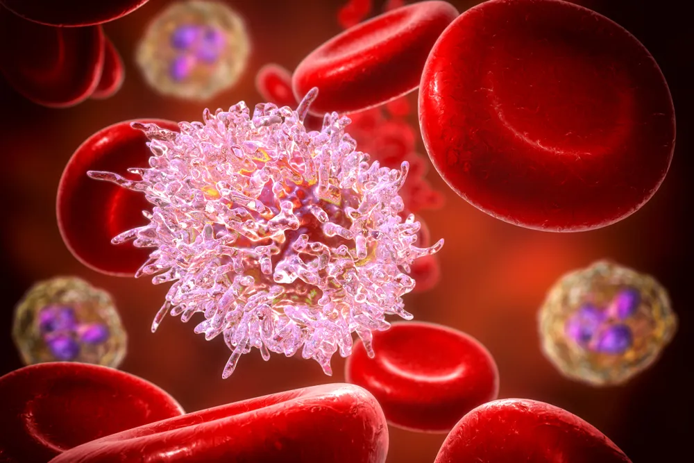 علائم سرطان خون چیست؟ + راه های درمان و معرفی انواع آن