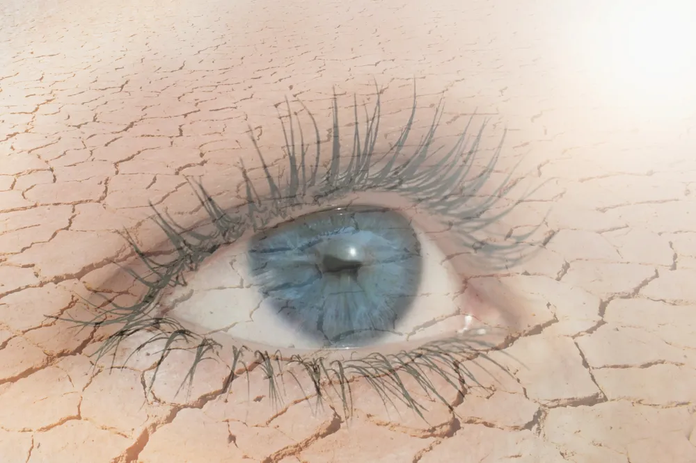 همه چیز درباره خشکی چشم | علت، درمان + روش های جلوگیری
