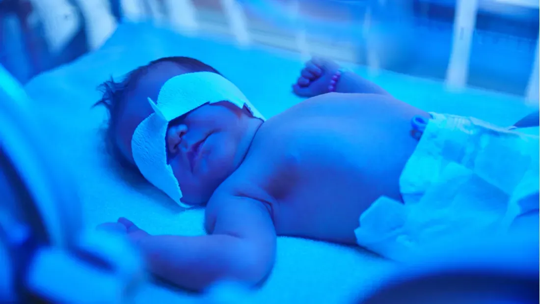 راه های درمان زردی نوزاد در خانه | بررسی علت زردی نوزاد